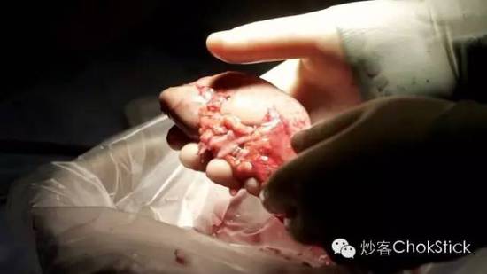 10 大死亡猛药逐个数: 就在我们身边,只是你不知道