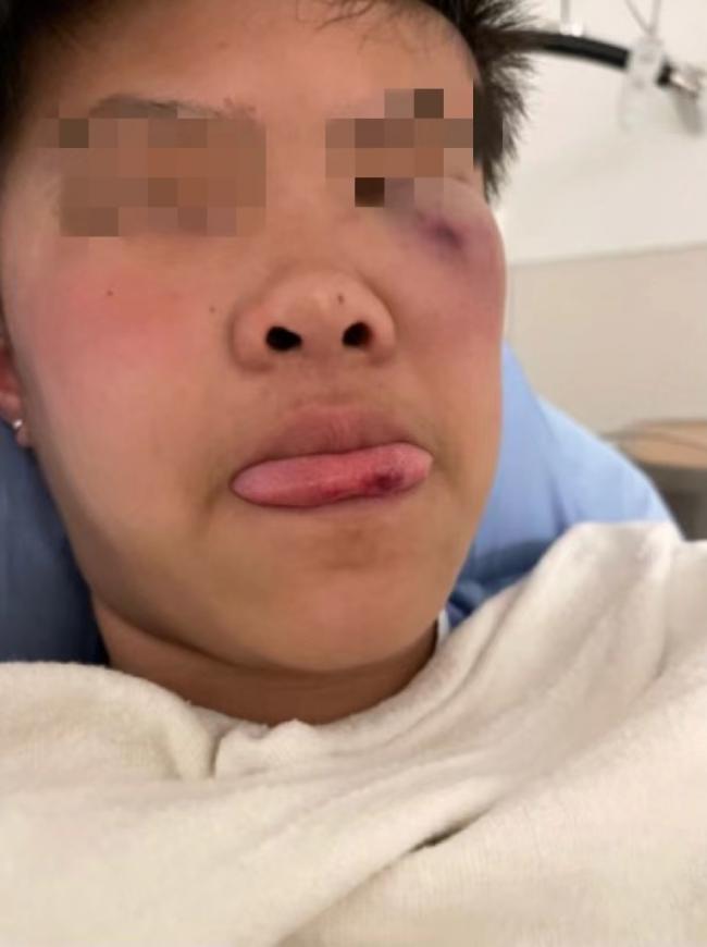 震惊!列治文14岁华裔女生,在学校被同学殴打致昏迷!下手太狠了… 震惊!列治文14岁华裔女生,在学校被同学殴打致昏迷!下手太狠了…